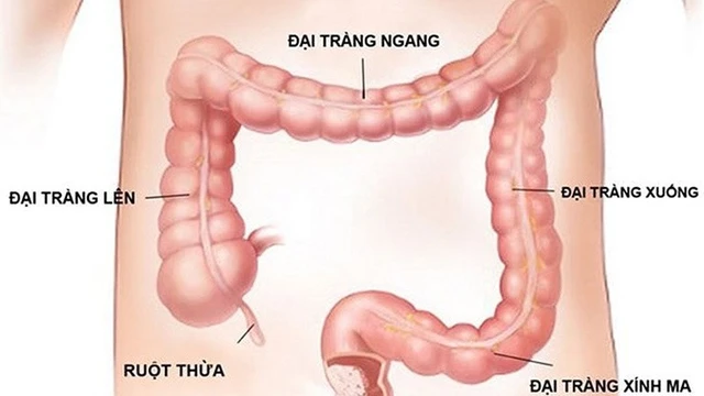 bai-viet/hieu-ro-hon-ve-polyp-dai-trang-ngang.html