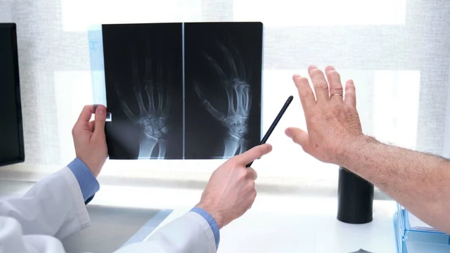 bai-viet/hinh-anh-chup-x-quang-viem-khop-dang-thap.html