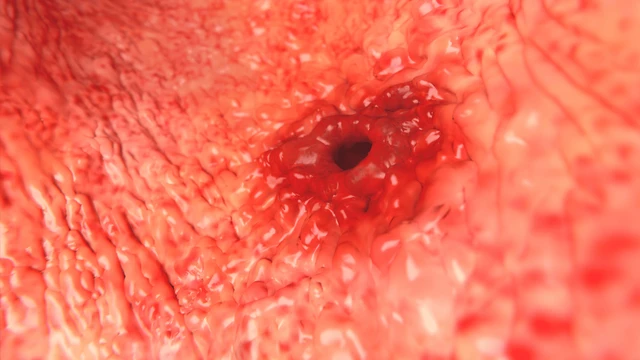 bai-viet/hinh-anh-noi-soi-da-day-phuong-phap-chan-doan-benh-da-day-hieu-qua.html