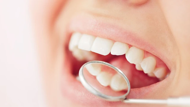 bai-viet/hinh-anh-rang-ho-nhe-cung-giai-phap-cai-thien.html