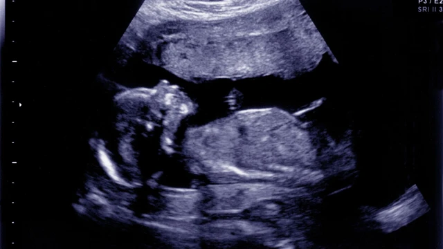 bai-viet/hinh-anh-sieu-am-be-gai-16-tuan-tuoi-nhung-dieu-me-bau-can-biet.html