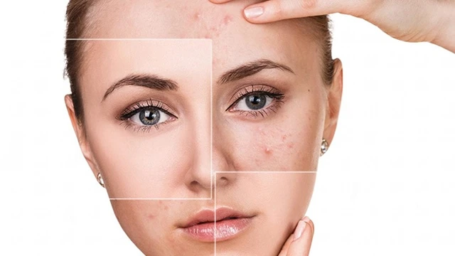 bai-viet/hiruscar-vs-oxy-hiruscar-co-lam-mo-seo-tham-nhu-chat-chong-oxy-hoa-65457.html