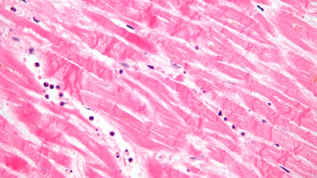 bai-viet/histopathology-la-gi-tam-quan-trong-cua-histopathology-mo-benh-hoc.html
