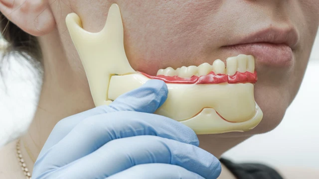 bai-viet/ho-ham-nhe-co-nieng-rang-duoc-khong-nhung-dieu-can-biet.html