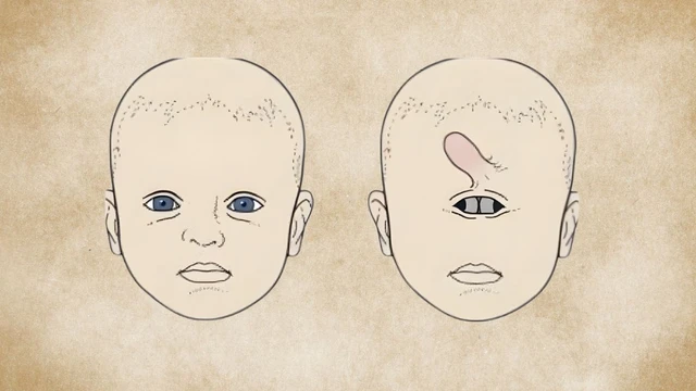 bai-viet/hoi-chung-cyclopia-la-gi-nguyen-nhan-va-tien-luong-benh.html