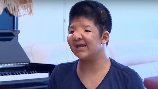 bai-viet/hoi-chung-apert-la-gi-nhung-nguyen-nhan-va-dau-hieu-nhan-biet-cua-hoi-chung-apert-70758.html