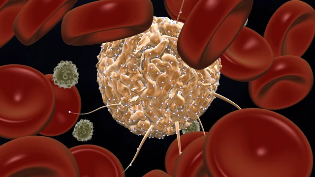 benh/hoi-chung-roi-loan-sinh-tuy.html