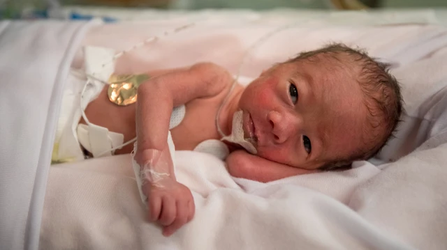 bai-viet/hoi-chung-thuy-dau-bam-sinh-o-tre-so-sinh-va-cach-phong-ngua.html