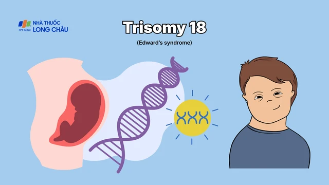 bai-viet/hoi-chung-trisomy-18-nguyen-nhan-chan-doan-va-muc-do-anh-huong-den-tre.html