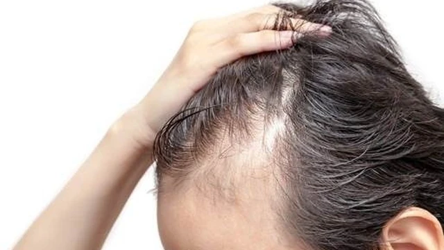 bai-viet/hoi-dau-di-truyen-co-chua-duoc-khong-1.html