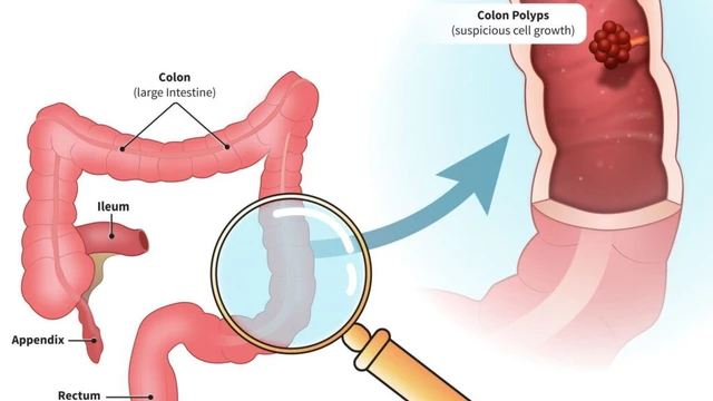 bai-viet/khuyen-cao-ve-sang-loc-ung-thu-dai-truc-trang-cua-hiep-hoi-tieu-hoa-hoa-ky.html