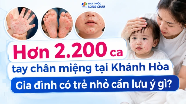 bai-viet/hon-2-200-ca-tay-chan-mieng-tai-khanh-hoa-gia-dinh-co-tre-nho-can-luu-y-gi-10009.html