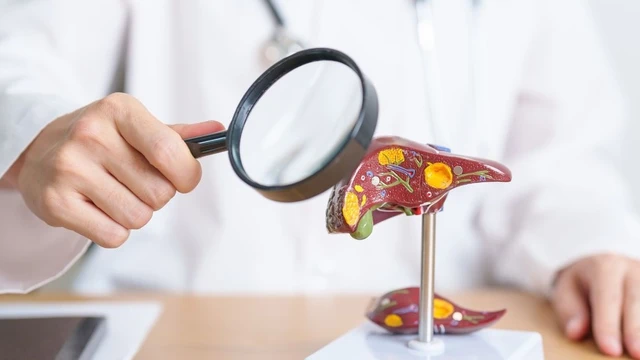 bai-viet/u-te-bao-bieu-mo-quanh-mach-mau-gan-tong-quan-trieu-chung-va-huong-dieu-tri.html