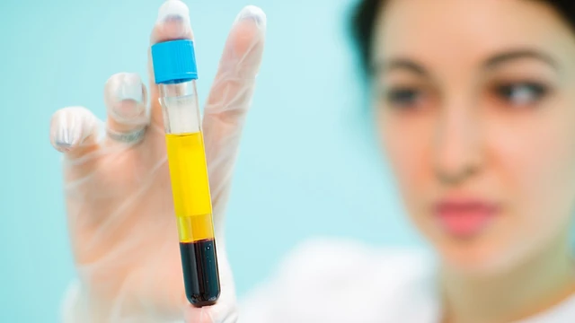 bai-viet/huyet-tuong-la-gi-huyet-tuong-co-chuc-nang-gi-72674.html