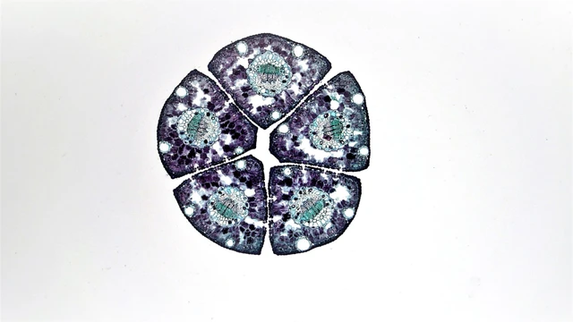 bai-viet/hyperplasia-la-gi-su-khac-biet-giua-tang-san-va-phi-dai-la-gi.html