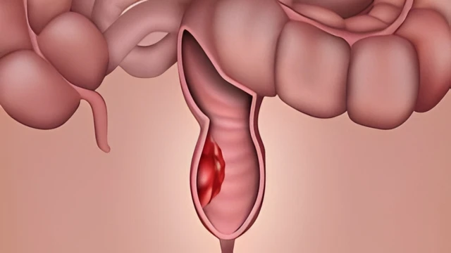 bai-viet/k-truc-trang-thap-nguyen-nhan-trieu-chung-va-cach-dieu-tri.html