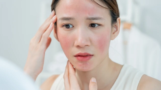 bai-viet/top-8-kem-duong-am-cho-viem-da-co-dia-diu-nhe-nen-dung.html