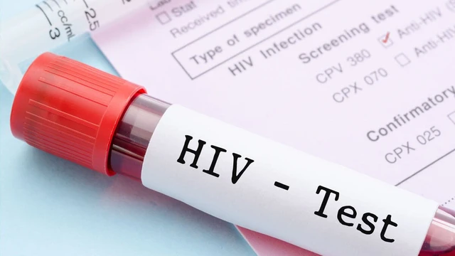 bai-viet/ket-qua-xet-nghiem-hiv-bao-gom-nhung-loai-nao.html