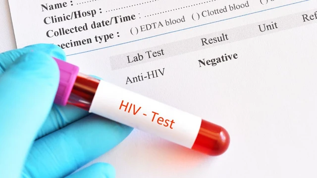 bai-viet/ket-qua-xet-nghiem-hiv-am-tinh-da-chac-chan-khong-nhiem-hiv-chua.html