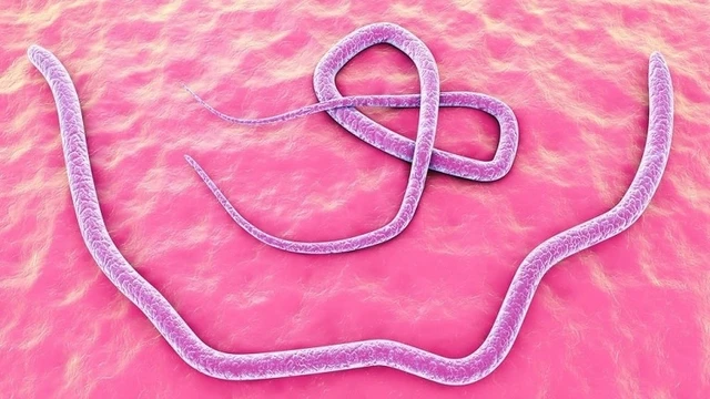 bai-viet/ket-qua-xet-nghiem-toxocara-igg-la-pos-3-5-od-nghia-la-gi.html