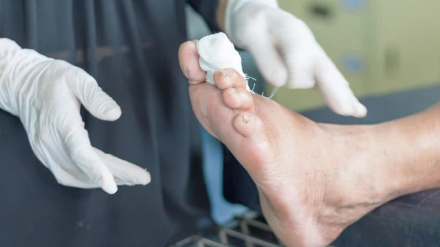 bai-viet/tam-quan-trong-va-quy-trinh-thuc-hien-kham-ban-chan-dai-thao-duong.html