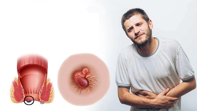 bai-viet/kham-benh-tri-la-kham-nhung-gi-review-quy-trinh-kham-benh.html