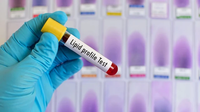 bai-viet/kham-mo-mau-o-dau-tot-tieu-chi-lua-chon-co-so-y-te-chat-luong.html