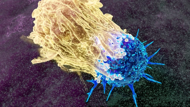 bai-viet/kham-tam-soat-ung-thu-la-gi-ai-nen-thuc-hien.html