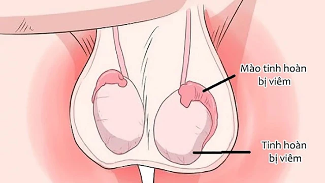 bai-viet/kham-tinh-hoan-co-the-phat-hien-nhung-benh-ly-gi.html