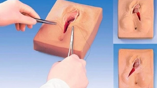 bai-viet/khau-tham-my-tang-sinh-mon-gia-bao-nhieu.html