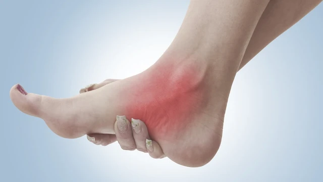 bai-viet/khi-bi-bong-gan-dung-thuoc-gi-de-nhanh-khoi-53275.html