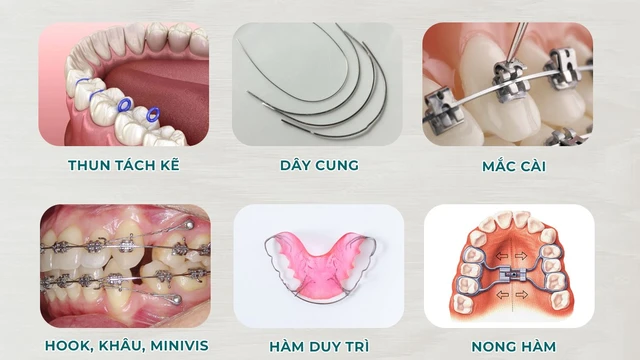 bai-viet/khi-cu-la-gi-vai-tro-cua-khi-cu-trong-nieng-rang.html