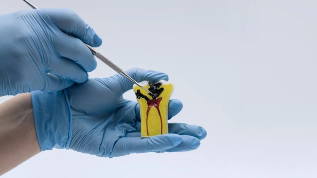 bai-viet/khi-nao-can-dieu-tri-tuy-rang-cac-dau-hieu-nhan-biet-som.html