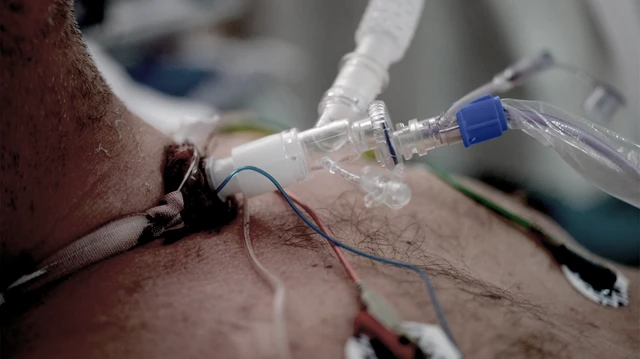 bai-viet/khi-nao-mo-khi-quan-cap-cuu-duoc-thuc-hien.html