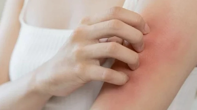 bai-viet/khi-nao-nen-su-dung-thuoc-mo-khang-sinh-boi-ngoai-da.html