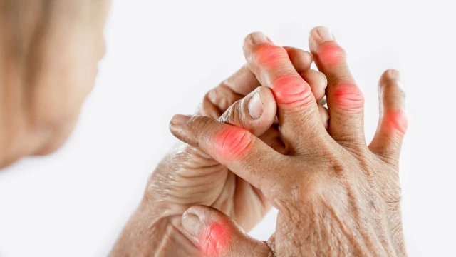 bai-viet/kho-khop-ngon-tay-nguyen-nhan-trieu-chung-cach-dieu-tri-hieu-qua.html