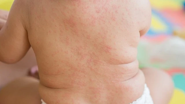 bai-viet/khoa-truyen-nhiem-gom-nhung-benh-gi.html