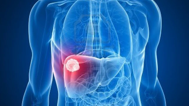 bai-viet/khoi-u-gan-10cm-co-nguy-hiem-khong.html