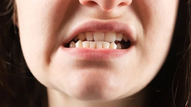 bai-viet/khop-can-nguoc-co-nen-tap-mewing-khong.html