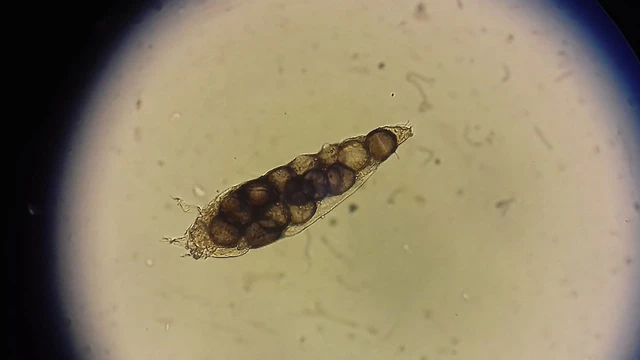 bai-viet/ky-sinh-trung-demodex-la-gi-trieu-chung-va-cach-dieu-tri.html