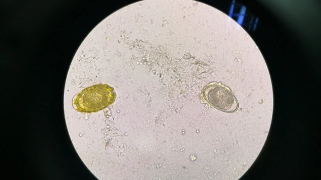 bai-viet/ky-sinh-trung-e-canis-co-lay-sang-nguoi-khong-dau-hieu-va-cach-phong-ngua.html