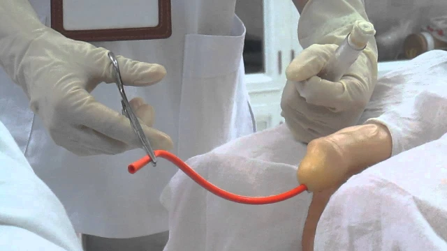 bai-viet/ky-thuat-bom-rua-bang-quang-la-gi-quy-trinh-va-luu-y-khi-thuc-hien.html