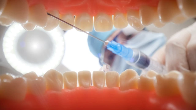 bai-viet/ky-thuat-gay-te-can-chop-la-gi-quy-trinh-thuc-hien-the-nao.html