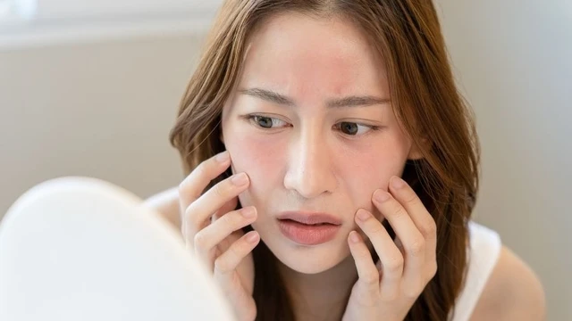 bai-viet/lam-sao-de-cai-thien-tinh-trang-da-kho-san-sui.html