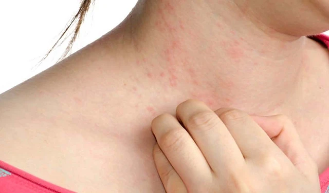 bai-viet/lam-sao-de-tri-noi-me-day-dut-diem-15821.html