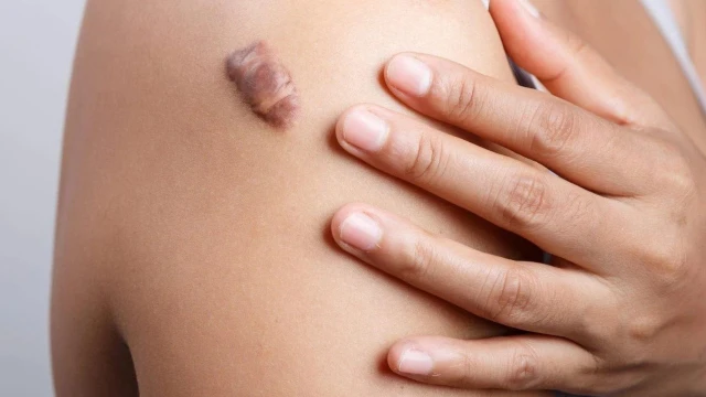 bai-viet/lam-the-nao-khi-seo-loi-bi-dau-54755.html