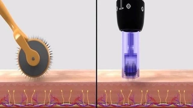 bai-viet/phan-biet-lan-kim-va-phi-kim-khac-nhau-nhu-the-nao.html