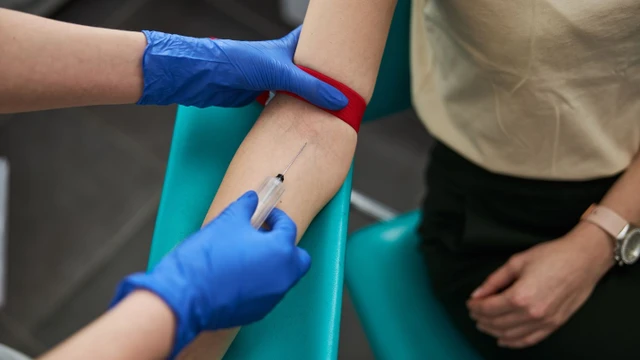 bai-viet/lay-mau-co-dau-khong-cach-giam-dau-khi-lay-mau.html