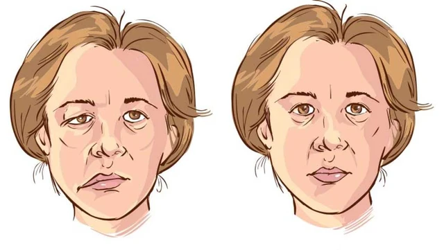 bai-viet/liet-mat-do-lanh-dau-hieu-nhan-biet-va-cach-khac-phuc.html