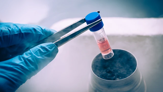 bai-viet/lieu-phap-te-bao-goc-cho-thay-trien-vong-trong-viec-phuc-hoi-hoat-dong-nao-sau-dot-quy.html